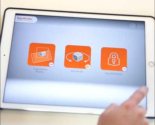 Ego Kiefer App Entwicklung